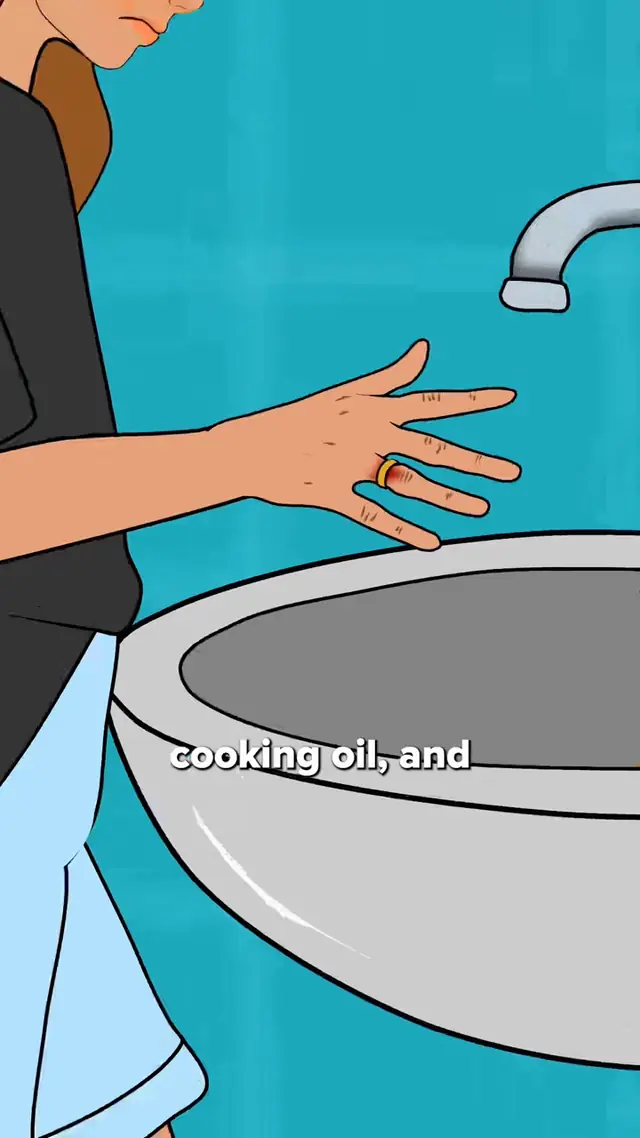 Got a ring that just won’t come off? Here’s a simple trick you’ll wis...